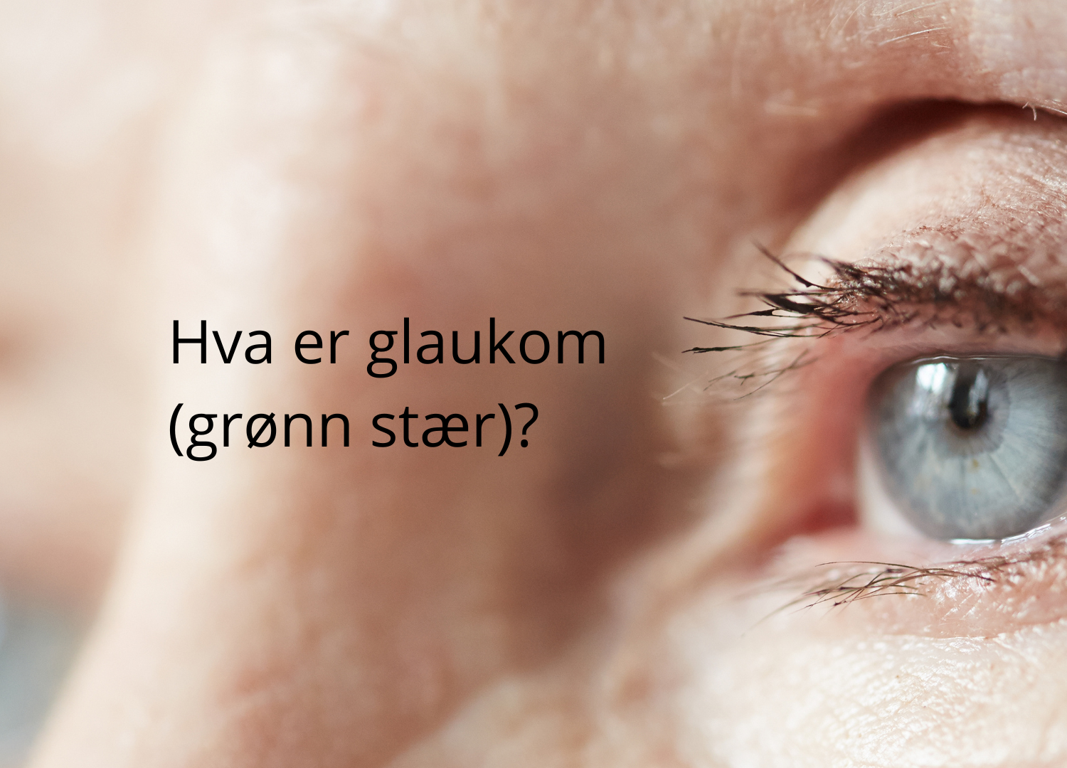 Hva er glaukom?
