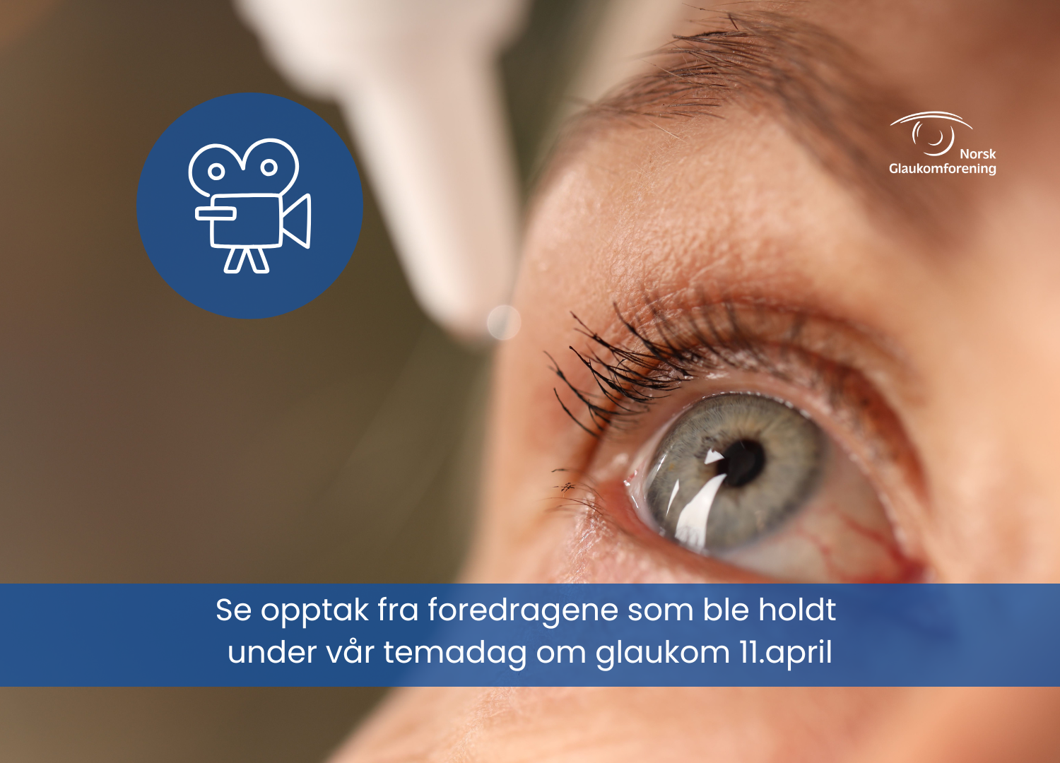 illustrasjonsfoto nærbilde av et øye som dryppes, med info tekst om at man kan se opptak av foredrag fra temadagen