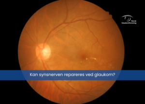 illustrasjonsfoto av en synsnerve